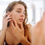 Pimples Treatment in Dubai