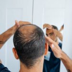 Stem Cell Hair Transplant in Dubai